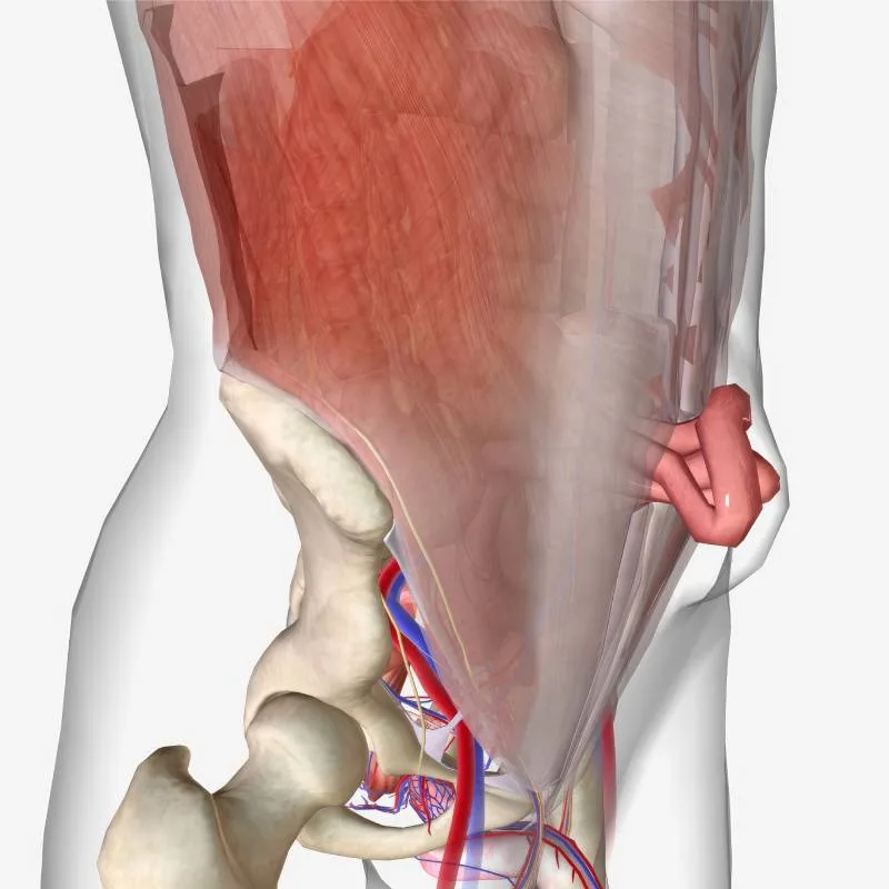 Modello anatomico che mostra le complicanze delle ernie della parete addominale