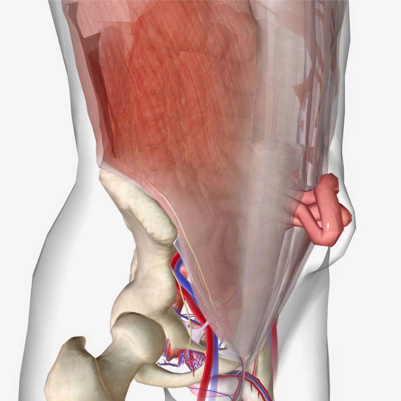 Modello anatomico che mostra le complicanze delle ernie della parete addominale